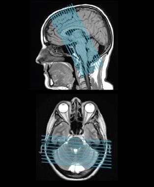 SIGNA™ Architect 128-channel Advanced AIR Edition Package SIGNA™ Architect 128-channel Advanced AIR Edition Package