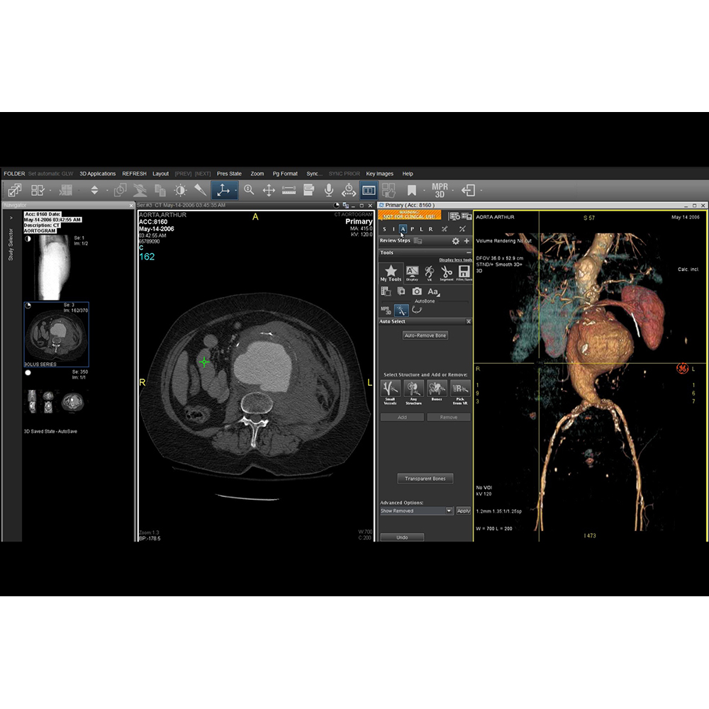 Centricity Perinatal (CPN) Centricity Perinatal (CPN)
